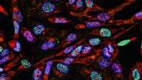Fluorescent Imaging immunofluorescence of cancer cells growing in 2D with nuclei in blue, cytoplasm in red and DNA damage foci in green